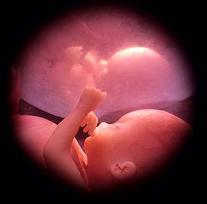 Nao aborto sagrado coracao.jpg