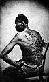220px-Cicatrices de flagellation sur un esclave.jpg